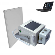 数字x线摄影与常规x线摄影的不同点