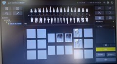 浙江客户订购的数字牙片机已发货