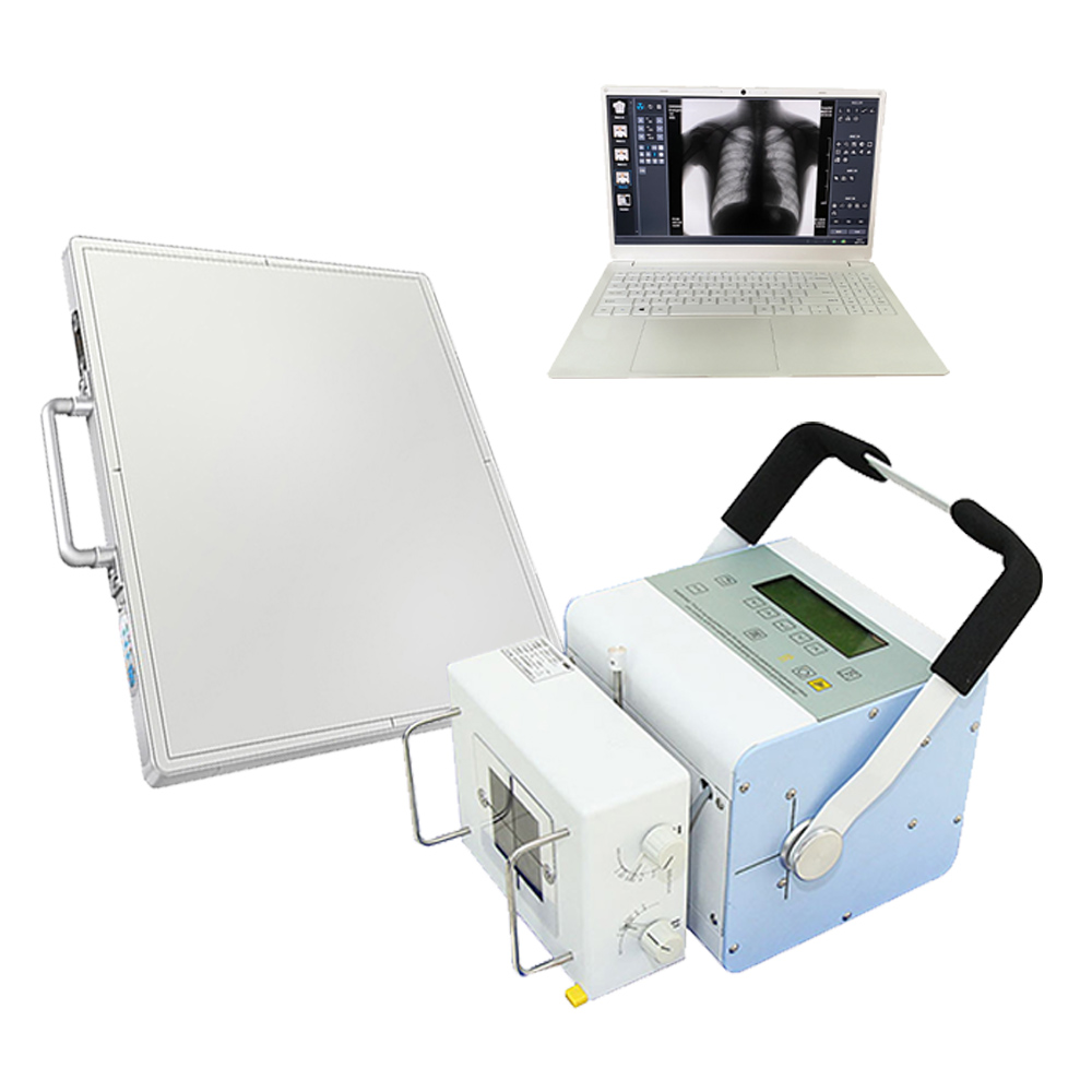 需要打印或洗胶片的X光机是DR的X光机吗？