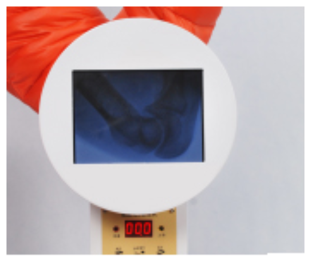 手提式透视机 效果图