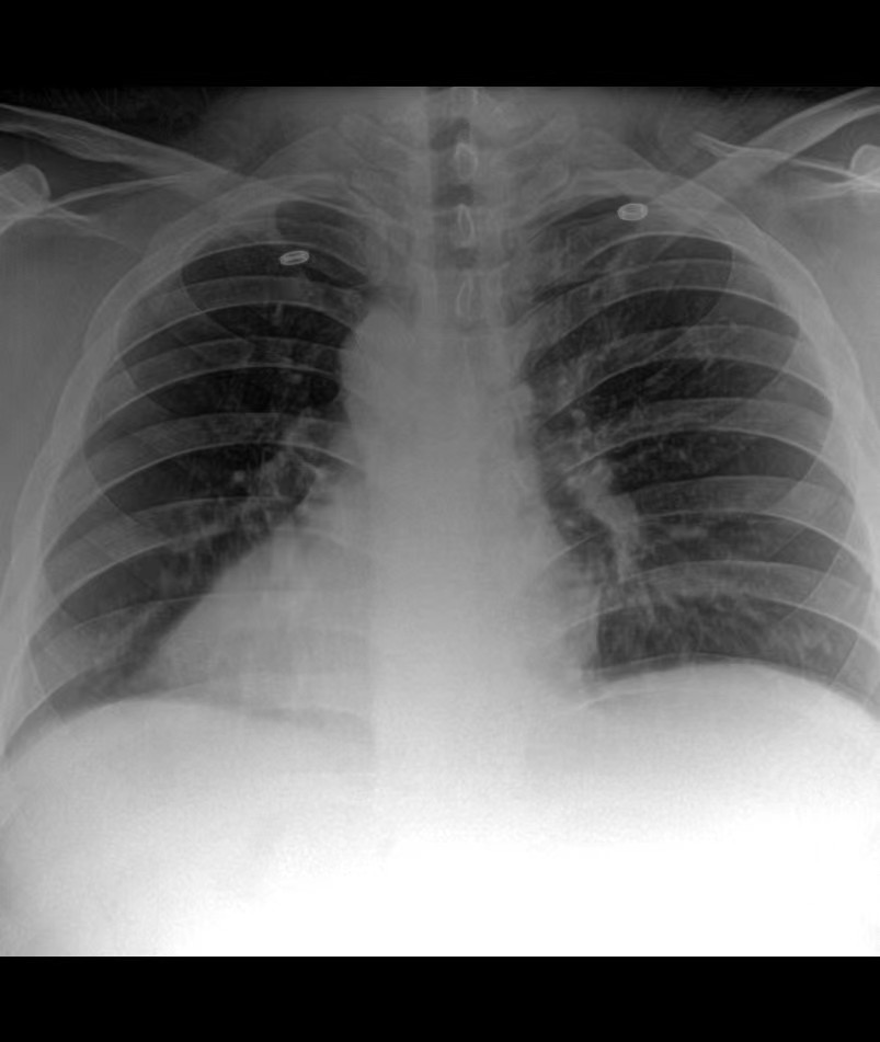 X光机成像效果图