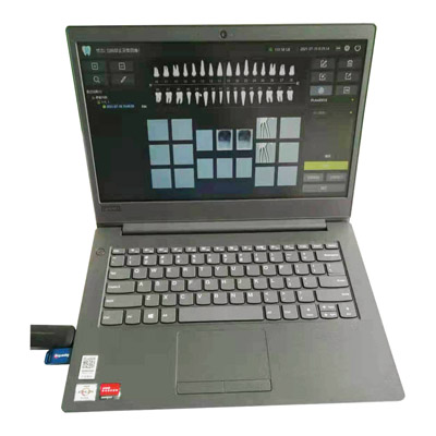 牙科X光机传感器（电脑软件图）