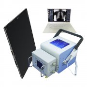 一套医用DR大概多少钱？（2022年价格）