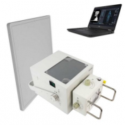 X线数字影像和普通X线胶片有什么区别呢