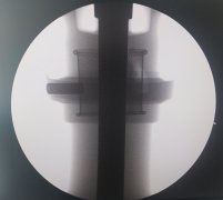 工业检测时产品内部零件的密度关系