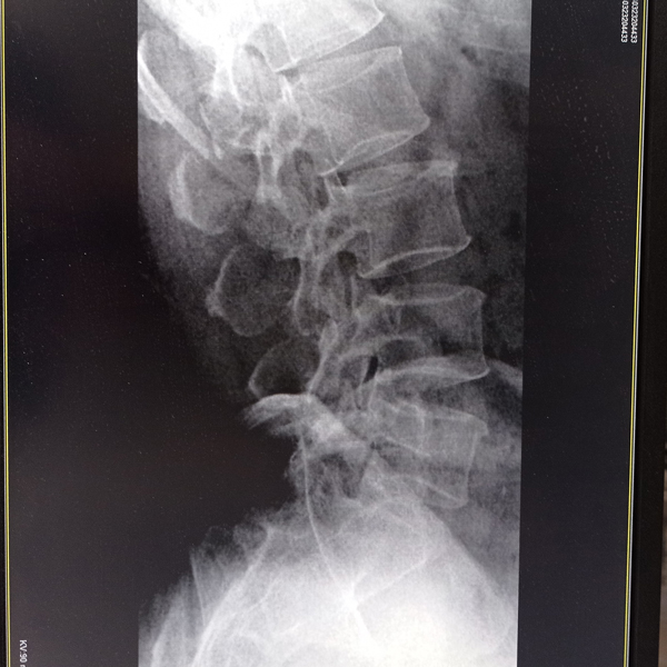 便携DR拍摄效果图