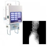 福建个人诊所询便携Ｘ光机