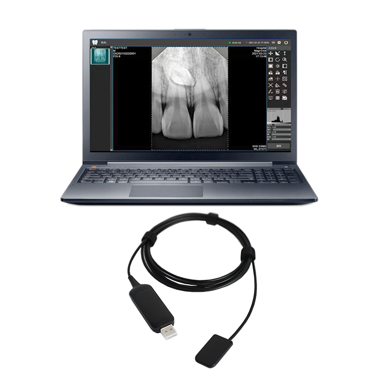 数字口腔牙科传感器