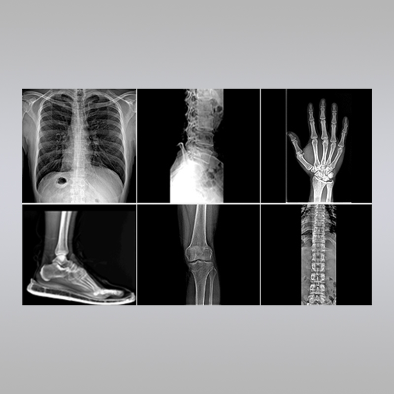 DRX光机拍摄效果图