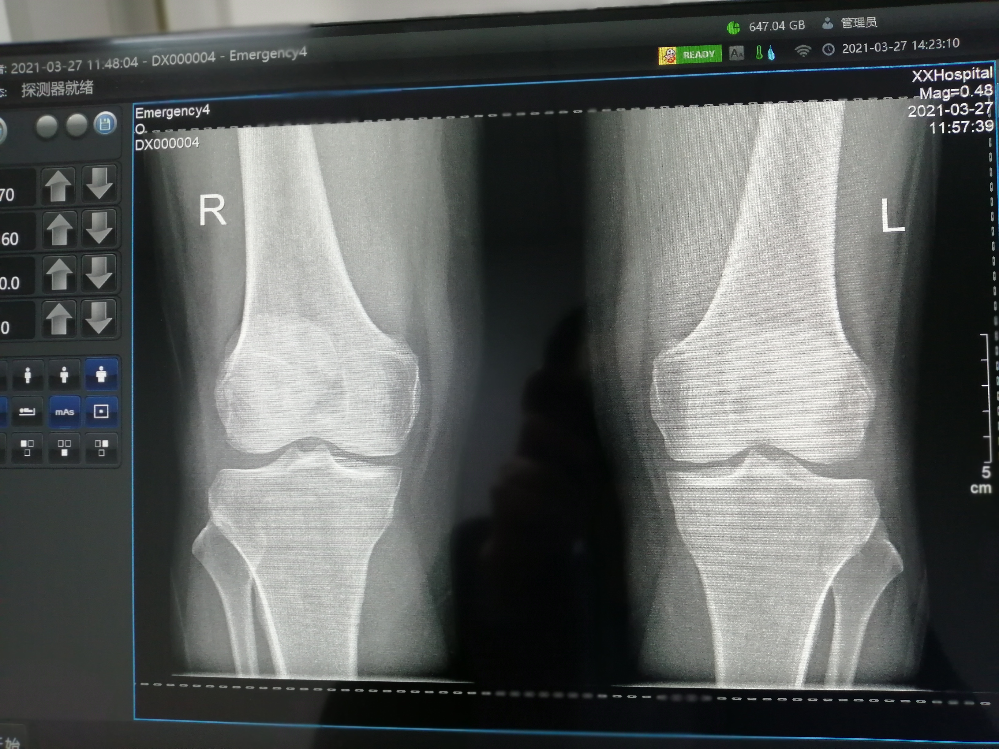 X光机拍片效果图