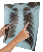 多次曝光对显影的影响