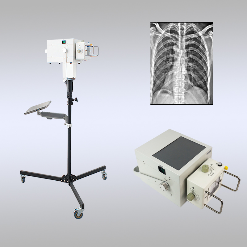 胸片专用便携式拍片机