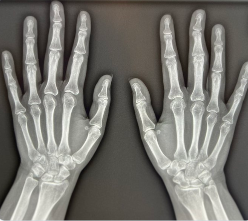 X光机医用摄片检查效果图